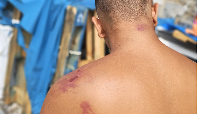 Amnistía Internacional denuncia torturas y tratos degradantes de militares a migrantes en Ceuta