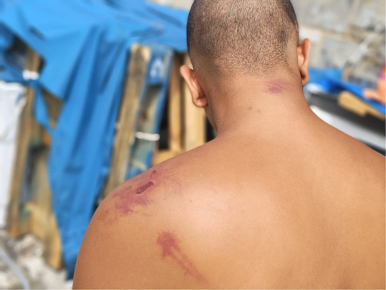 Amnistía Internacional denuncia torturas y tratos degradantes de militares a migrantes en Ceuta